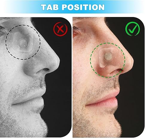 Nasal Strips